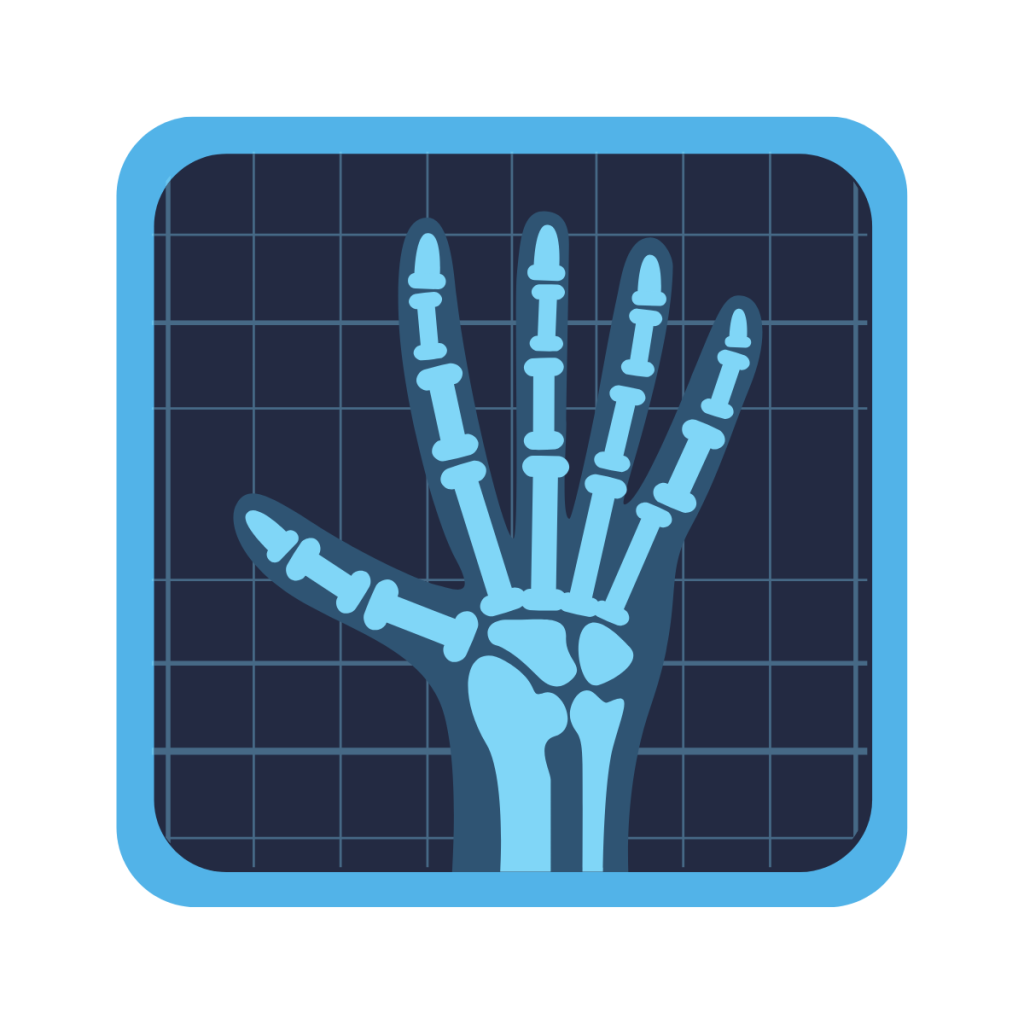 This is an illustration of a hand under an x-ray. The hand shows the bones of the hand. This image is used by patient guard to demonstrate an example of a class IIb medical device.
