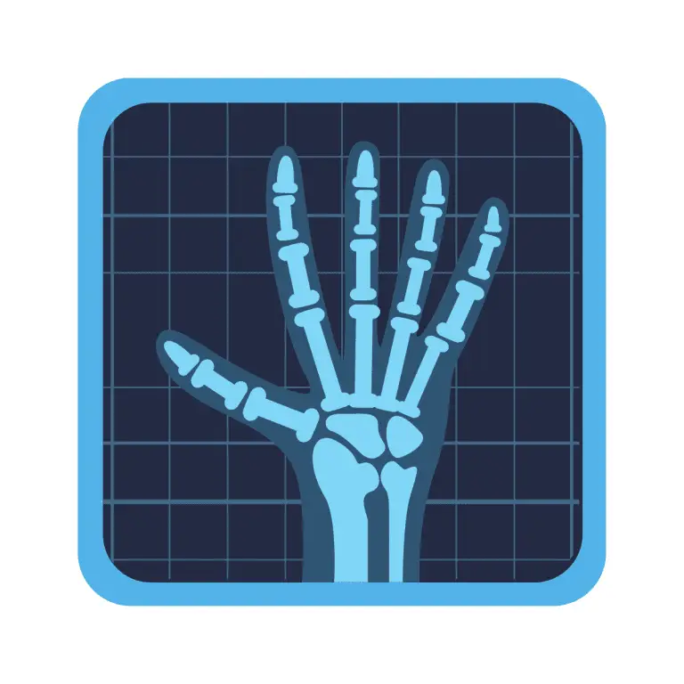 Medical Devices Classification - This is an illustration of a hand under an x-ray. The hand shows the bones of the hand. This image is used by patient guard to demonstrate an example of a class IIb medical device.